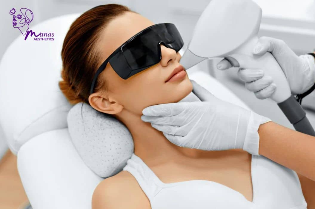 Pico Laser Treatment - Manas Aesthetic