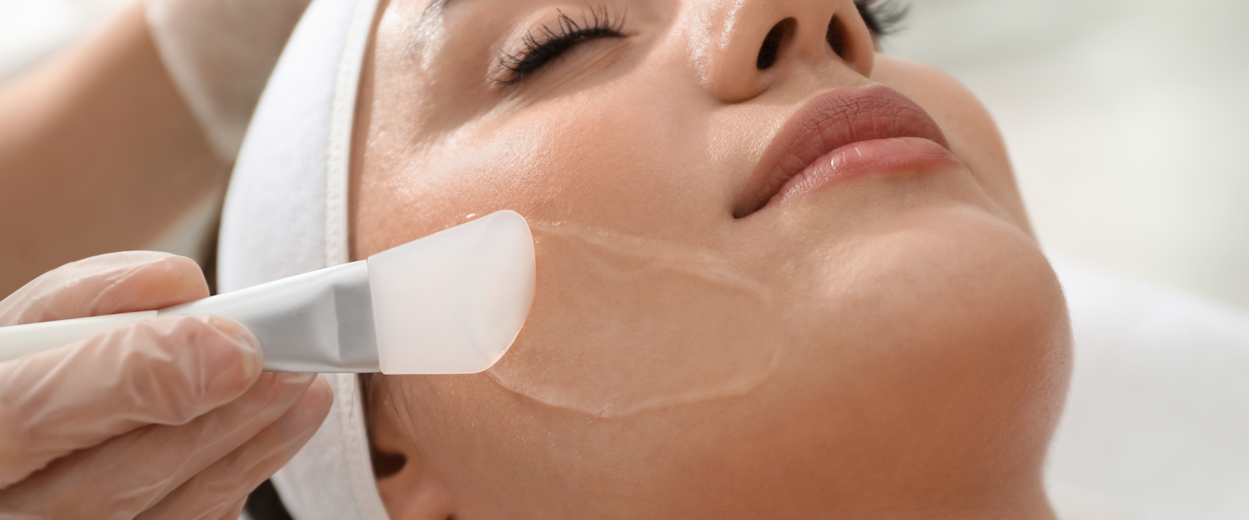 Chemical Peel Treatment