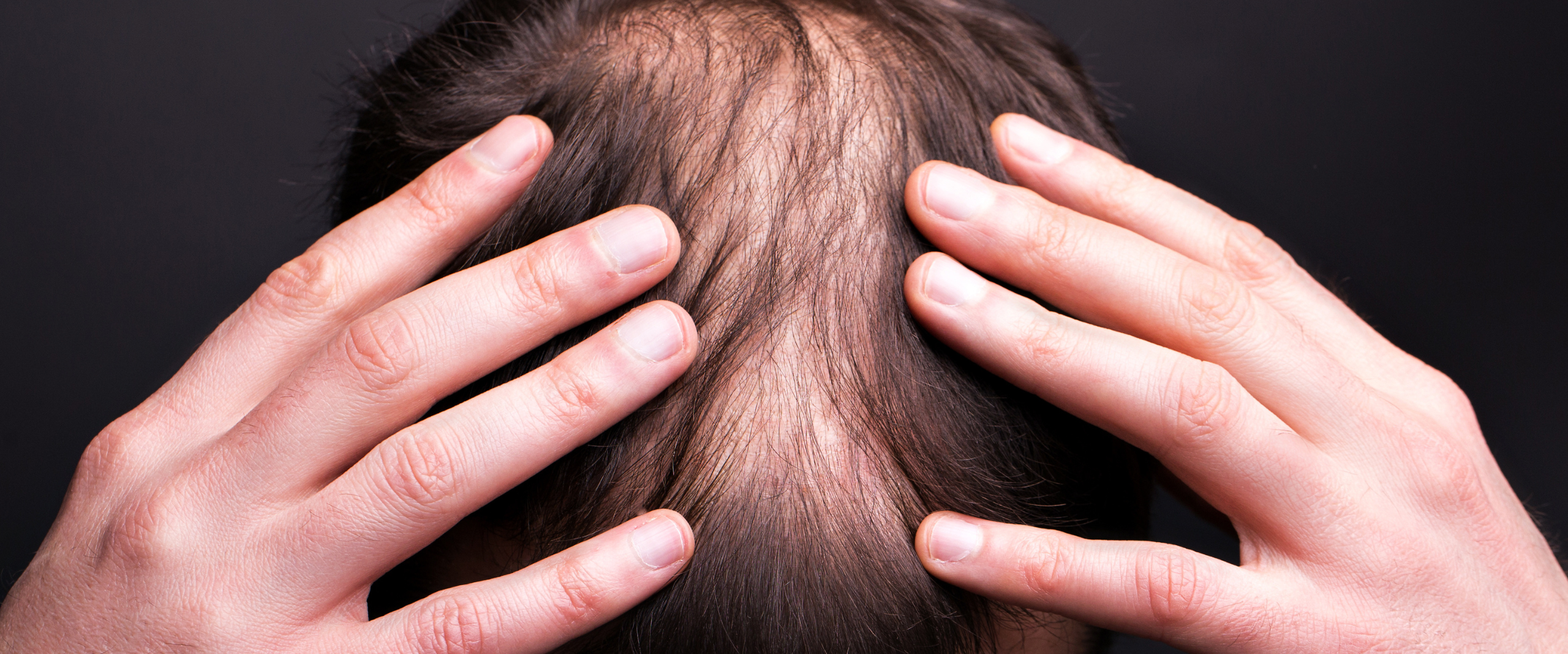 Hair Thinning Treatment