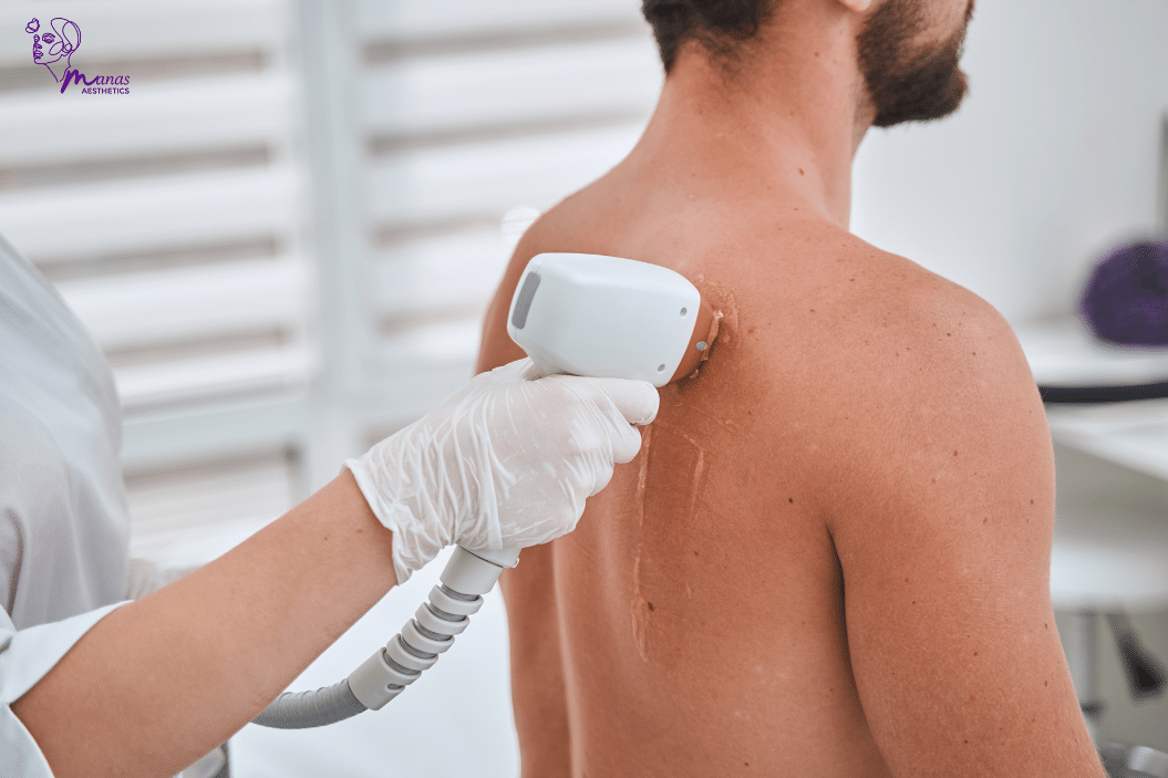 Tan Removal